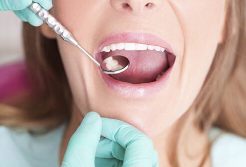 A woman undergoing a dental oral health exam.
