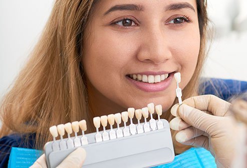 No, veneers (dental veneers) do not ruin your teeth.