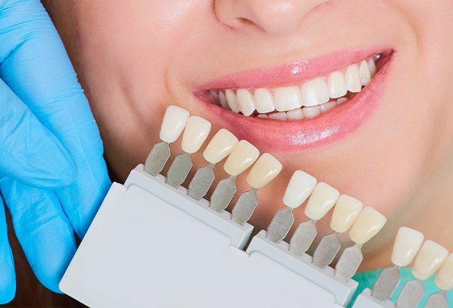 Getting your teeth whitened is a way to brighten your smile and make yourself feel better about your appearance. The cost of prescription teeth whitening at the dentist's office is usually $400.
