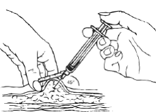 Insert the needle at a 45 degree angle - Illustration