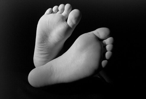 Elevated blood glucose levels can cause foot problems.