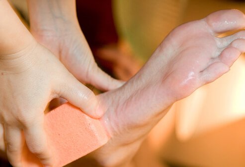 After bathing, use a pumice stone or emery board to smooth hardened areas of the feet that contain corns and calluses.