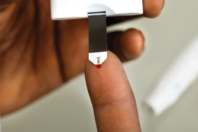 High blood sugar damages nerves and blood vessels so keep your numbers within a healthy range.