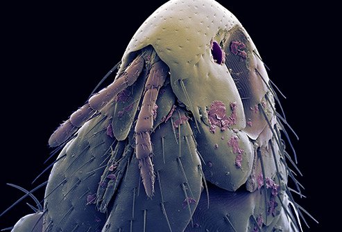 Bites from infected fleas cause bubonic and septicemic plague.