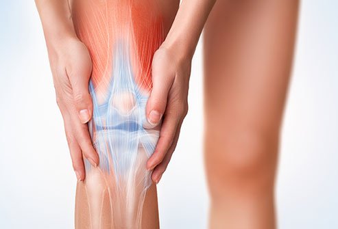 A dislocated knee causes severe pain.