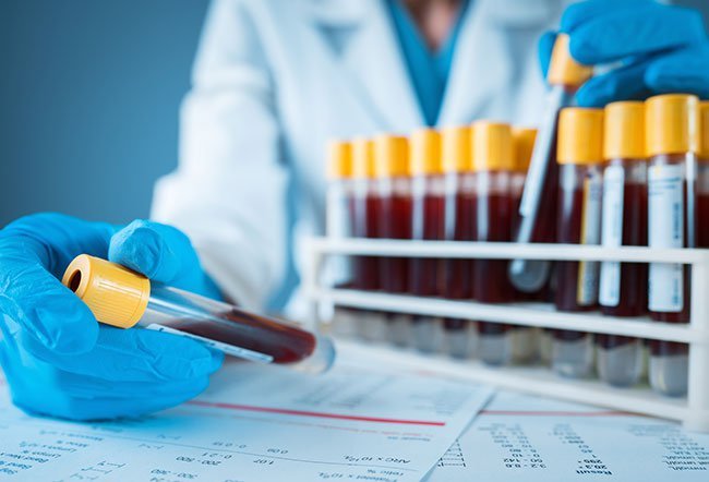 cancer blood test