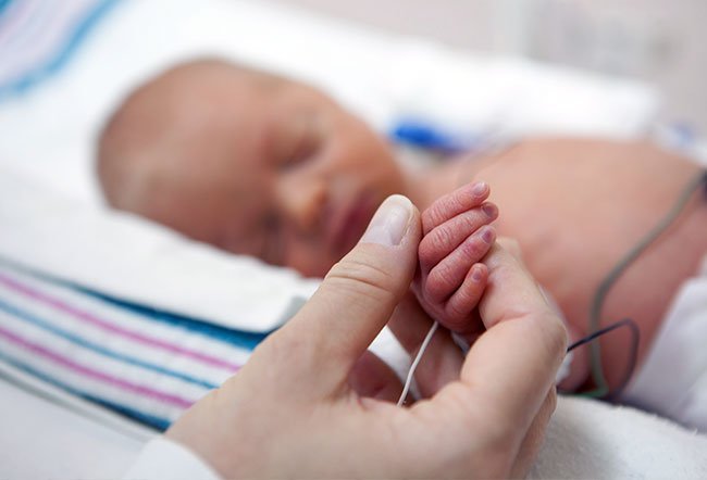 premature babies