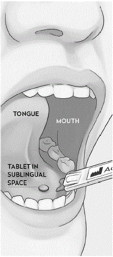 SDA Placement for Administration - Illustration