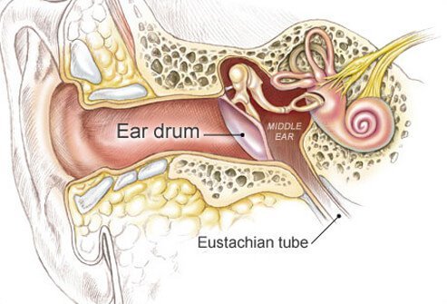 Middle ear infections are caused by bacteria and viruses.