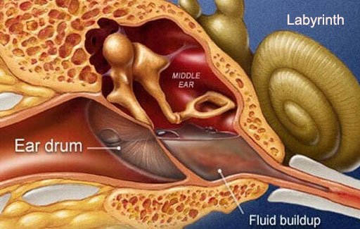 Labyrinthitis is inflammation inside the inner ear.