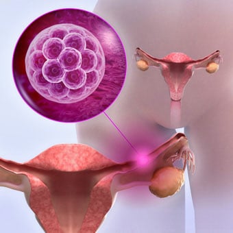 All ectopic pregnancies can be dangerous, requiring prompt medical intervention.