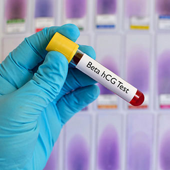 Diagnosing ectopic pregnancy includes a standard pregnancy test and physical exam.