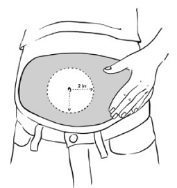 Inject EGRIFTA SV into the stomach-area - Illustration