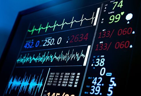 An electrocardiogram or electrocardiograph (ECG or EKG)
