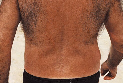 Most men have hair on their backs.