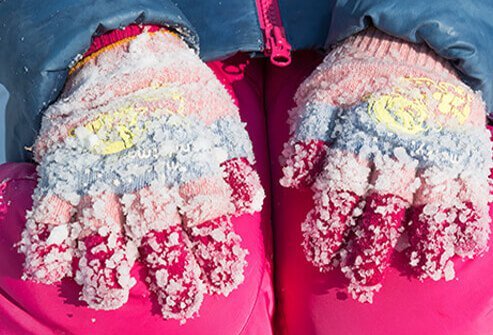 Know the signs and symptoms of frostbite so you can seek medical attention quickly.