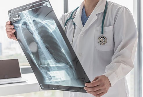 Emphysema is a chronic lung disease that makes breathing difficult. Early symptoms include difficulty breathing, persistent cough, extreme fatigue, and more. Learn about other warning signs symptoms, causes, diagnose, and treatment options.