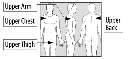 Place the EMSAM transdermal system (patch) on one of the following areas (sites) on your body - Illustration