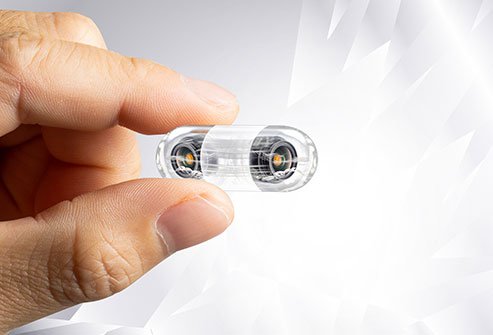 Sometimes endoscopes are cameras on long tubes, but in recent years technology has allowed doctors to mount cameras in small pills to reduce the risk of complications and unpleasantness.