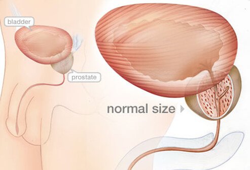 The prostate gland is located below the bladder in men and produces fluid components of semen.