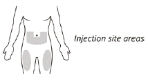 Choose the injection site - Illustration