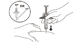 Use a quick, dart-like motion to insert the needle at an angle between 45° to 90° - Illustration