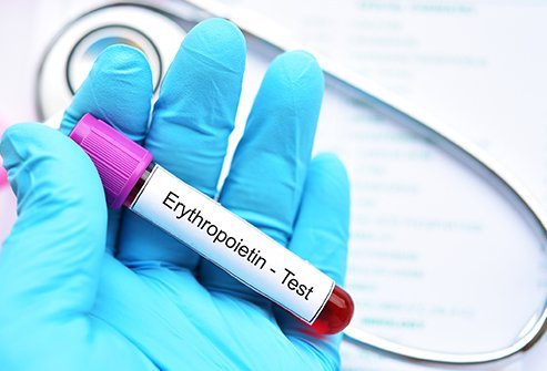 Measuring blood levels of erythripoietin, a hormone involved in red blood cell production, can diagnose some medical conditions.