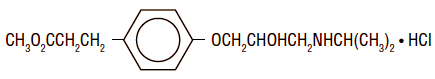 BREVIBLOC (Esmolol Hydrochloride) Structural Formula Illustration
