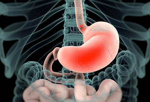 Esophageal manometry uses pressure sensors to test the function of the muscles in the esophagus.