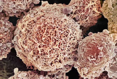 Pap smears are critical for a woman's health.