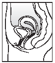 The exact position of ESTRING is not critical - Illustration
