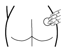   Estraderm® estradiol transdermal system including the buttocks and abdomen Illustration