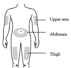 Prepare and clean two injection sites - Illustration