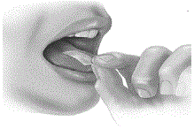 Place Film on Tongue - Illustration