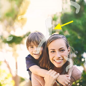 The appearance of eye floaters varies among patients.
