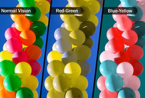 Colorblindness causes an inability to distinguish red and green or blue and yellow.