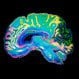 Brain Damage: Symptoms, Causes, Treatment