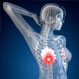 Breast Cancer Facts