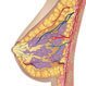 Fibrocystic Breast Condition