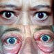 Graves' Disease