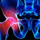 What Does Tendonitis Feel Like in the Hip?