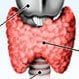 Larynx Cancer (Throat Cancer)