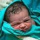 How Do You Treat Jaundice in Newborns?