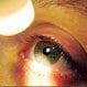 Pink Eye (Conjunctivitis): Types, Treatment, and Symptoms