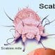 Scabies