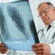 Is Tuberculosis (TB) Contagious?