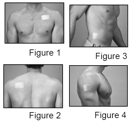 Fentanyl Transdermal System application areas - Illustration