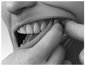 your mouth above a rear molar tooth between the
upper cheek and gum - Illustration
