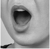 When placing the tablet under your tongue, first lift
your tongue (4b), then place the tablet under your tongue (4c), and lower your
tongue over the tablet (4d) - Illustration