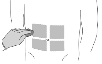 Insert the needle into the skin at a 45 degree angle all the way to the hub. - Illustration